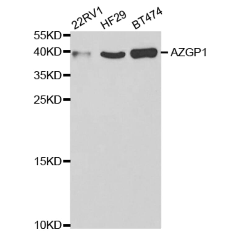 Anti-AZGP1 Antibody from Bioworld Technology (BS7558) - Antibodies.com