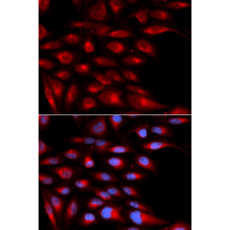 Anti-AZGP1 Antibody from Bioworld Technology (BS7558) - Antibodies.com