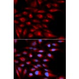 Anti-AZGP1 Antibody from Bioworld Technology (BS7558) - Antibodies.com