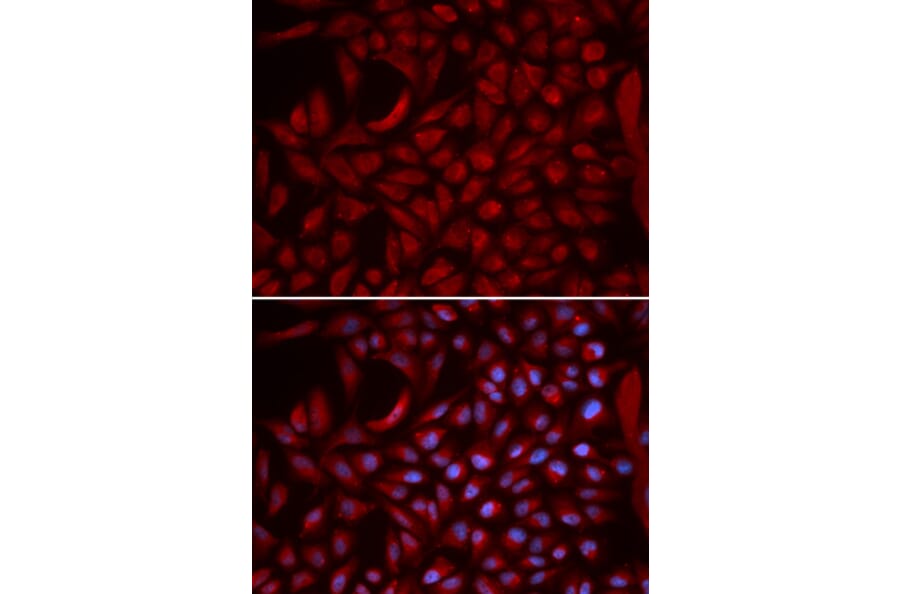 Anti-CUL5 Antibody from Bioworld Technology (BS7559) - Antibodies.com