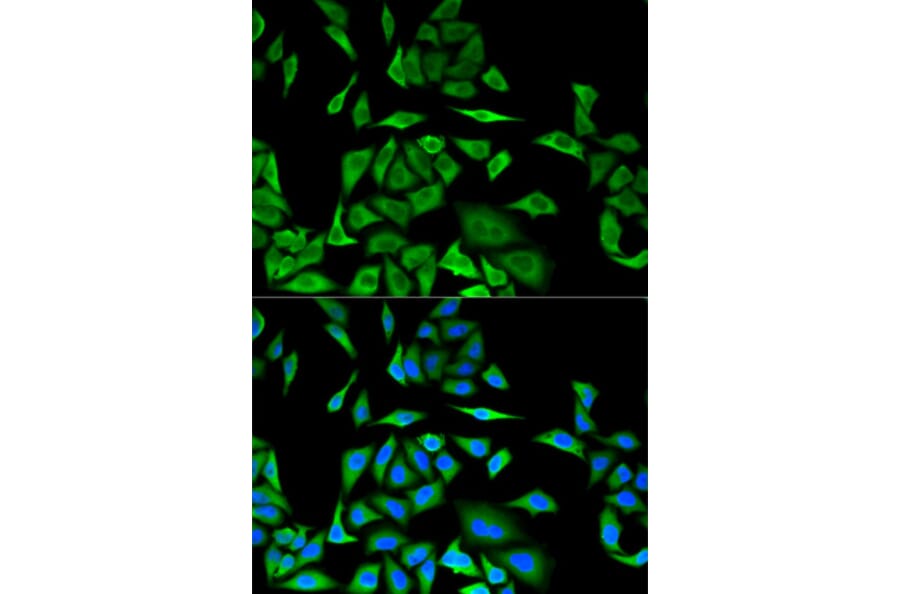 Anti-DBI Antibody from Bioworld Technology (BS7560) - Antibodies.com