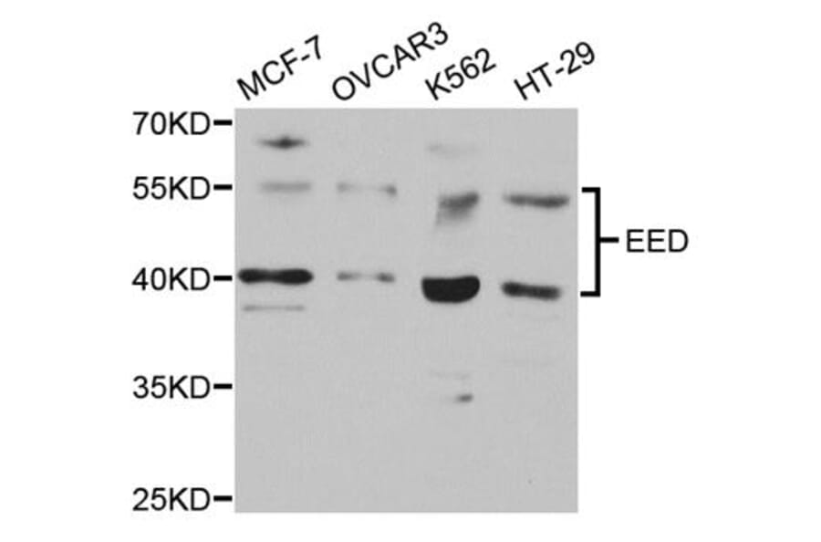 Anti-EED Antibody from Bioworld Technology (BS7561) - Antibodies.com