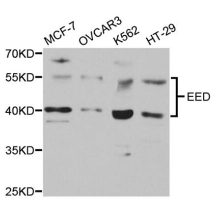 Anti-EED Antibody from Bioworld Technology (BS7561) - Antibodies.com