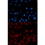 Anti-PA2G4 Antibody from Bioworld Technology (BS7563) - Antibodies.com