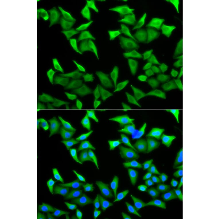 Anti-PVRL2 Antibody from Bioworld Technology (BS7564) - Antibodies.com