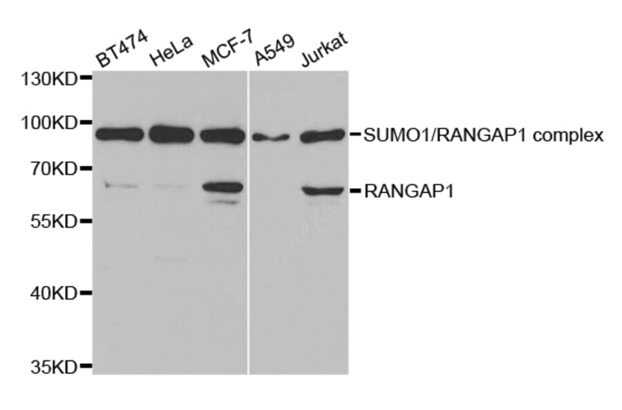 Anti-RANGAP1 Antibody from Bioworld Technology (BS7566) - Antibodies.com