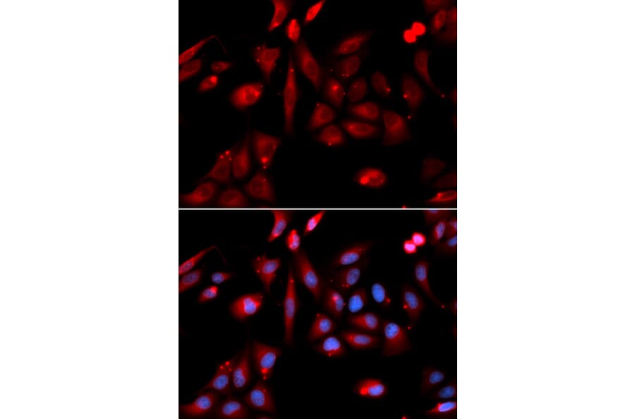 Anti-RANGAP1 Antibody from Bioworld Technology (BS7566) - Antibodies.com