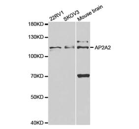 Anti-AP2A2 Antibody from Bioworld Technology (BS7570) - Antibodies.com