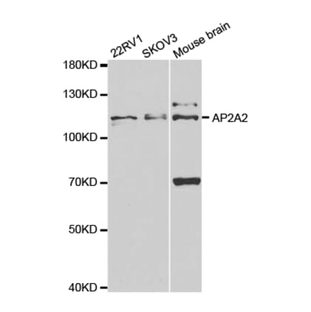Anti-AP2A2 Antibody from Bioworld Technology (BS7570) - Antibodies.com
