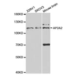 Anti-AP2A2 Antibody from Bioworld Technology (BS7570) - Antibodies.com