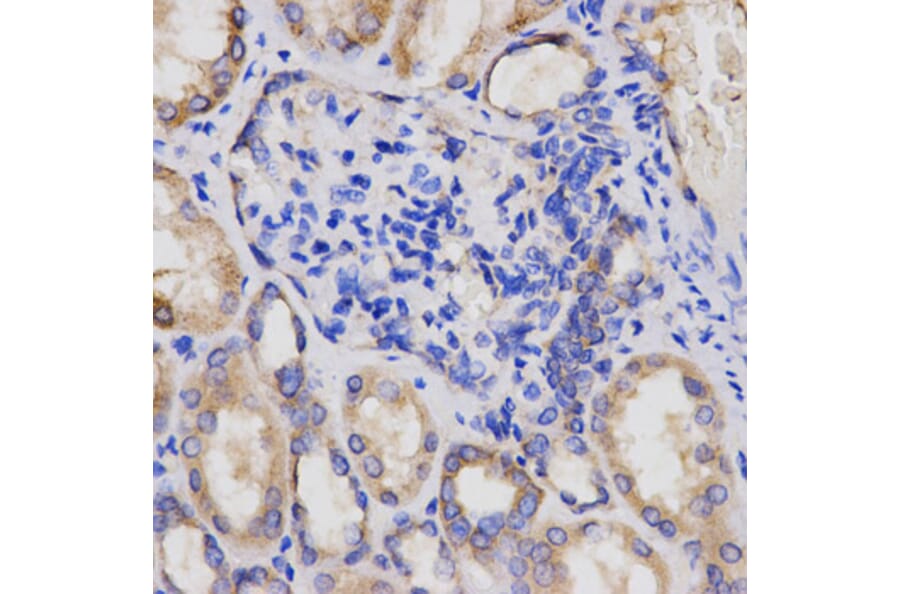 Anti-AP2A2 Antibody from Bioworld Technology (BS7570) - Antibodies.com