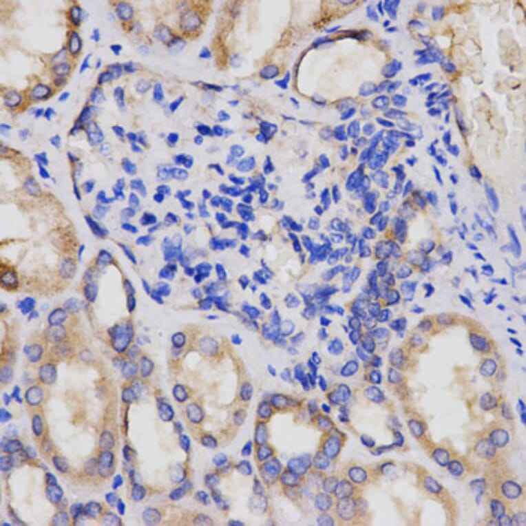 Anti-AP2A2 Antibody from Bioworld Technology (BS7570) - Antibodies.com