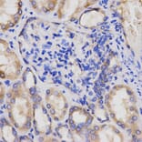 Anti-AP2A2 Antibody from Bioworld Technology (BS7570) - Antibodies.com