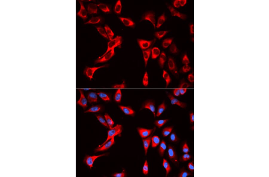 Anti-EIF4B Antibody from Bioworld Technology (BS7572) - Antibodies.com