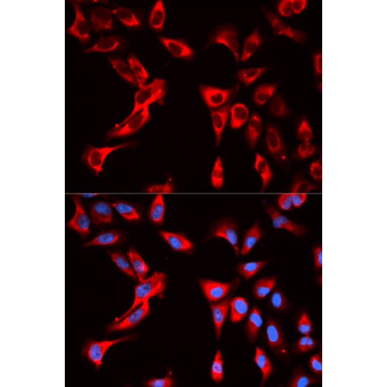 Anti-EIF4B Antibody from Bioworld Technology (BS7572) - Antibodies.com