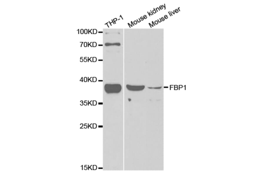 Anti-FBP1 Antibody from Bioworld Technology (BS7573) - Antibodies.com