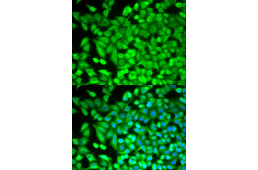 Anti-FBP1 Antibody from Bioworld Technology (BS7573) - Antibodies.com