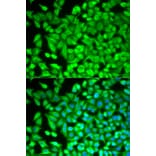 Anti-FBP1 Antibody from Bioworld Technology (BS7573) - Antibodies.com
