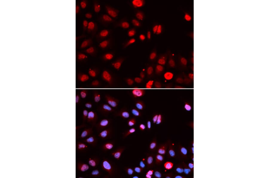 Anti-MPG Antibody from Bioworld Technology (BS7575) - Antibodies.com