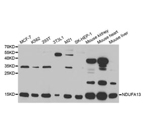 Anti-NDUFA13 Antibody from Bioworld Technology (BS7576) - Antibodies.com