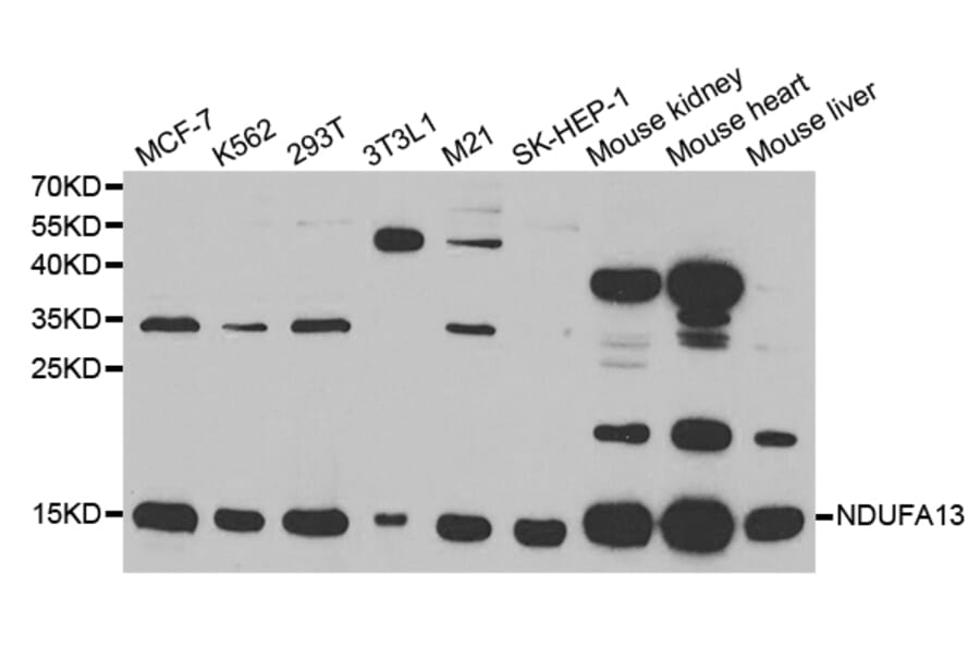 Anti-NDUFA13 Antibody from Bioworld Technology (BS7576) - Antibodies.com