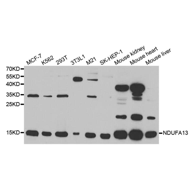 Anti-NDUFA13 Antibody from Bioworld Technology (BS7576) - Antibodies.com