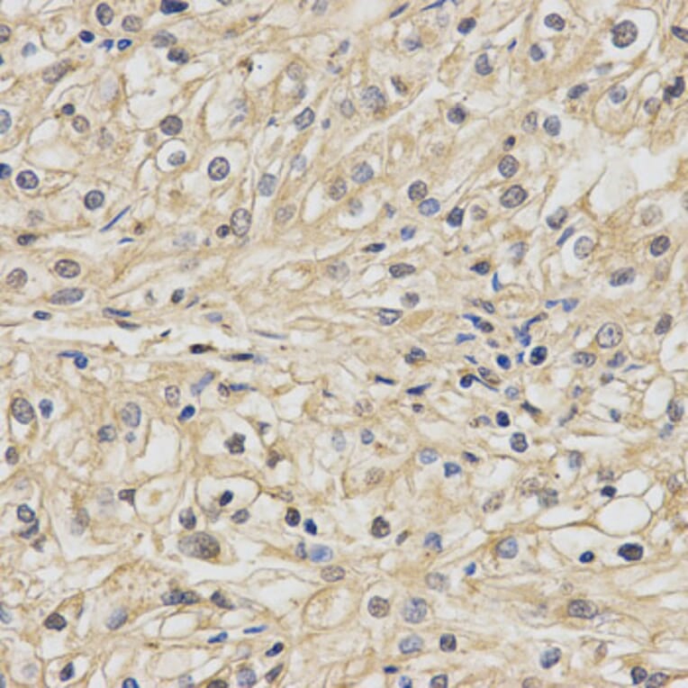 Anti-NDUFA13 Antibody from Bioworld Technology (BS7576) - Antibodies.com