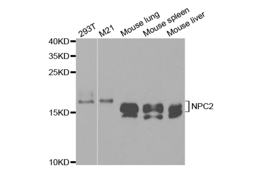 Anti-NPC2 Antibody from Bioworld Technology (BS7577) - Antibodies.com