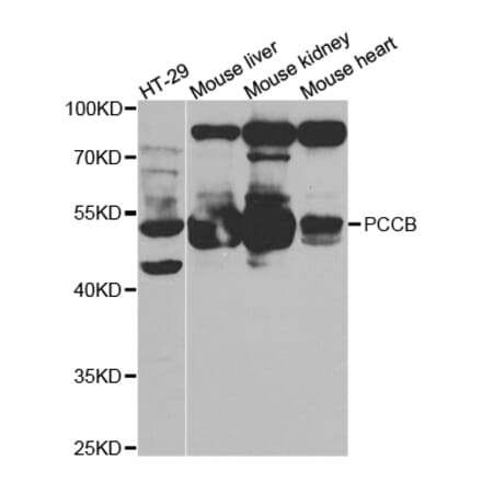 Anti-PCCB Antibody from Bioworld Technology (BS7578) - Antibodies.com