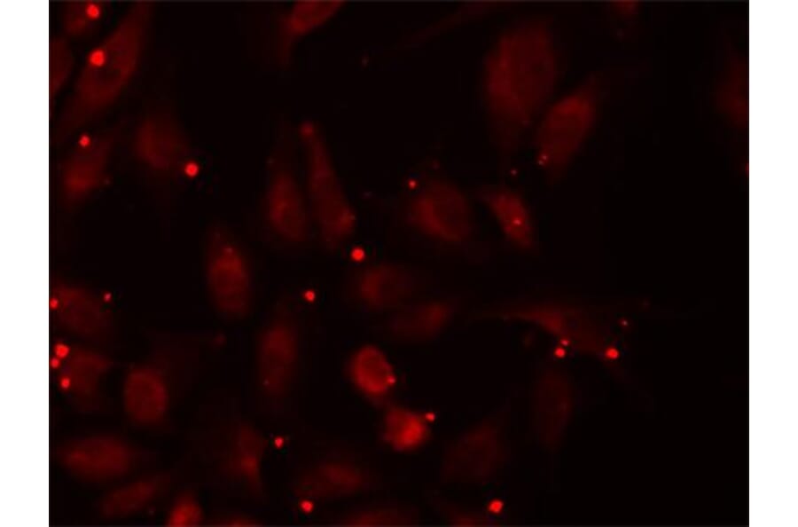 Anti-PCCB Antibody from Bioworld Technology (BS7578) - Antibodies.com