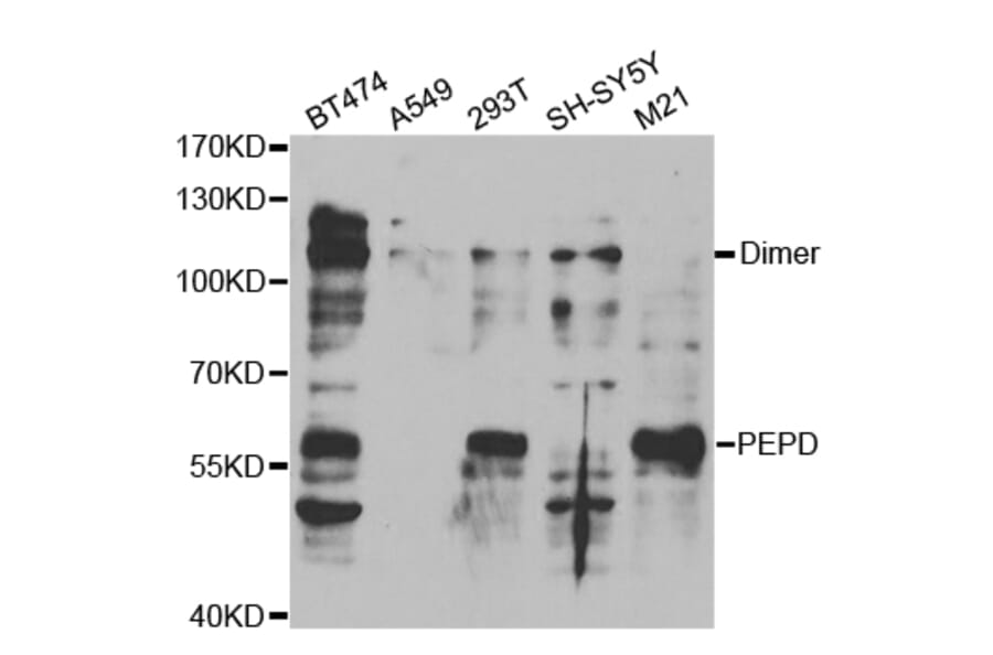 Anti-PEPD Antibody from Bioworld Technology (BS7579) - Antibodies.com