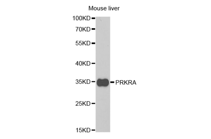 Anti-PRKRA Antibody from Bioworld Technology (BS7580) - Antibodies.com