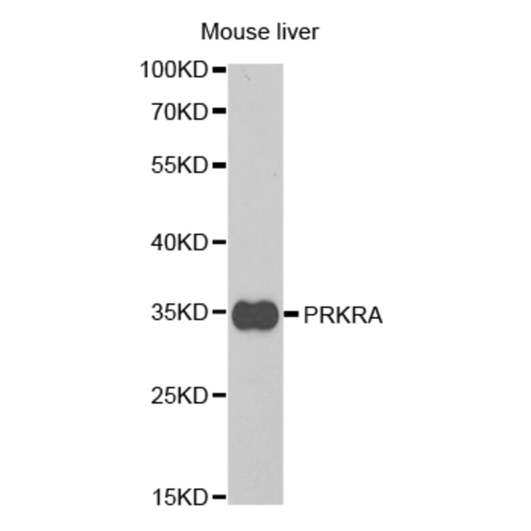 Anti-PRKRA Antibody from Bioworld Technology (BS7580) - Antibodies.com