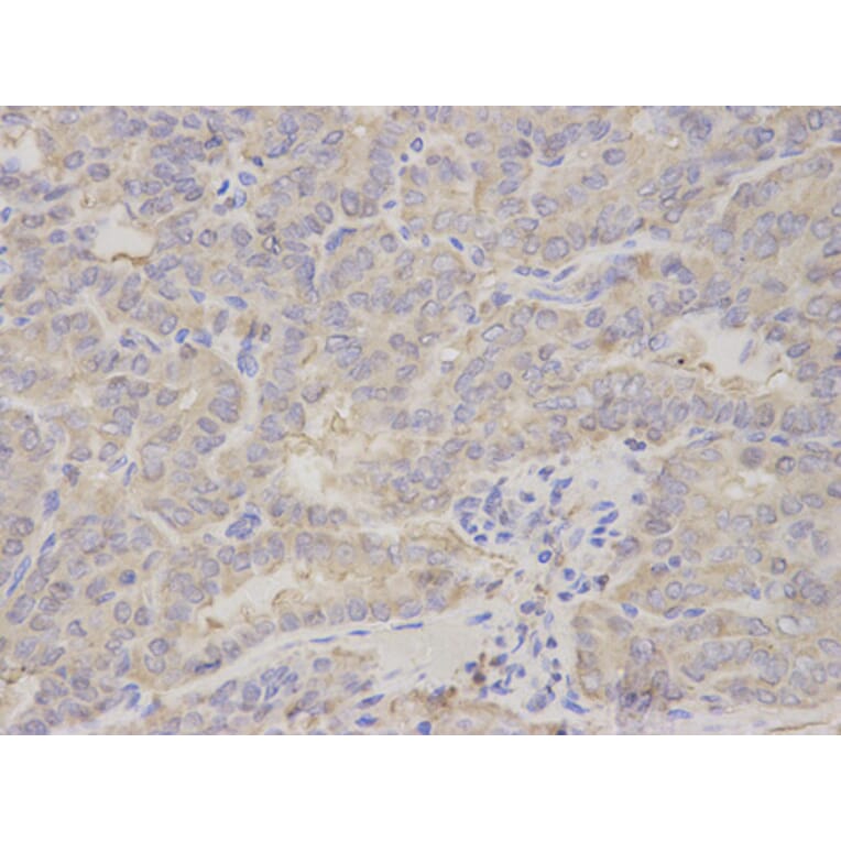 Anti-PRKRA Antibody from Bioworld Technology (BS7580) - Antibodies.com