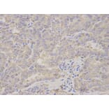 Anti-PRKRA Antibody from Bioworld Technology (BS7580) - Antibodies.com