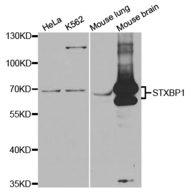 Anti-STXBP1 Antibody from Bioworld Technology (BS7582) - Antibodies.com