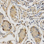 Anti-STXBP1 Antibody from Bioworld Technology (BS7582) - Antibodies.com