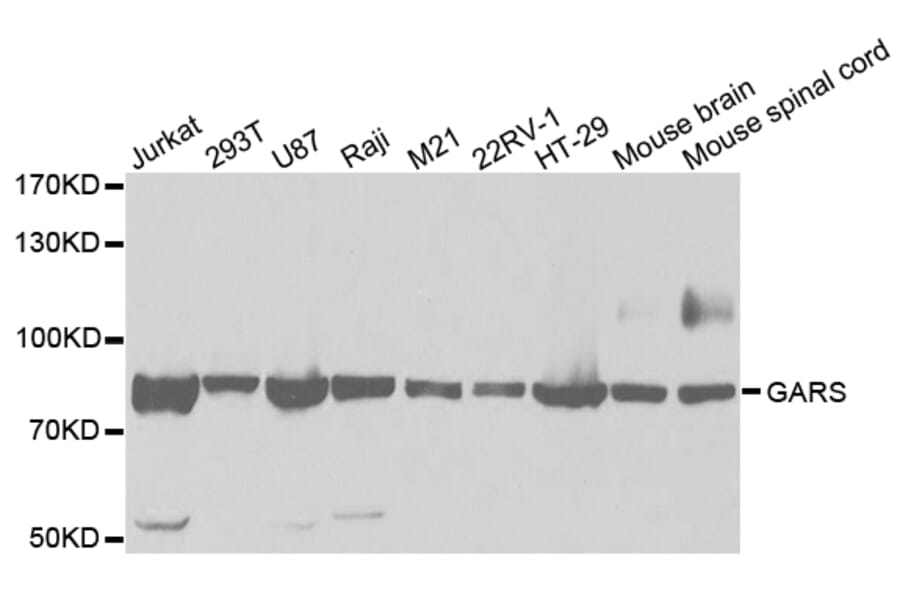 Anti-GARS Antibody from Bioworld Technology (BS7584) - Antibodies.com