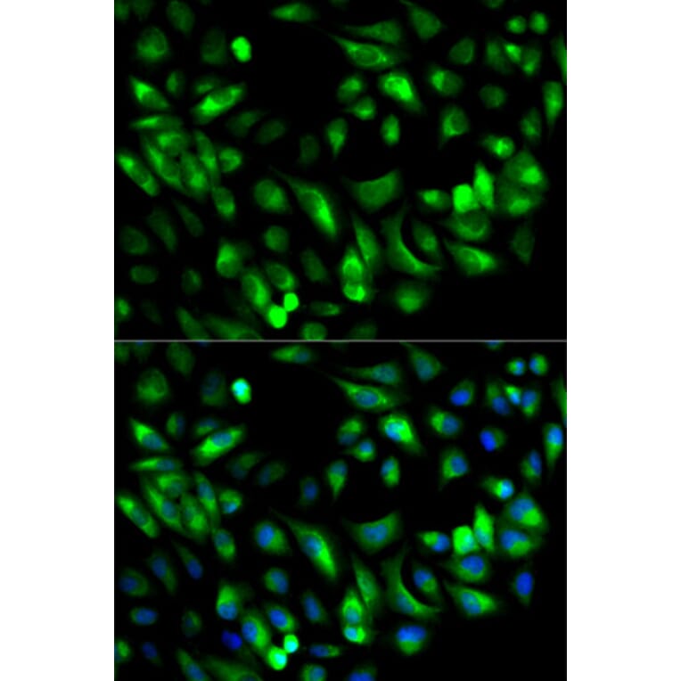 Anti-GARS Antibody from Bioworld Technology (BS7584) - Antibodies.com