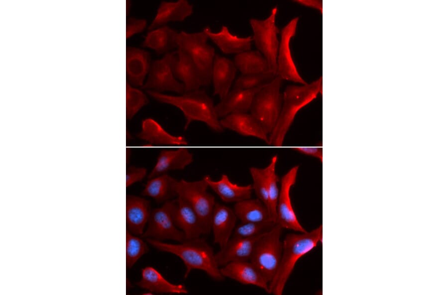 Anti-NQO2 Antibody from Bioworld Technology (BS7585) - Antibodies.com