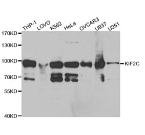 Anti-KIF2C Antibody from Bioworld Technology (BS7587) - Antibodies.com