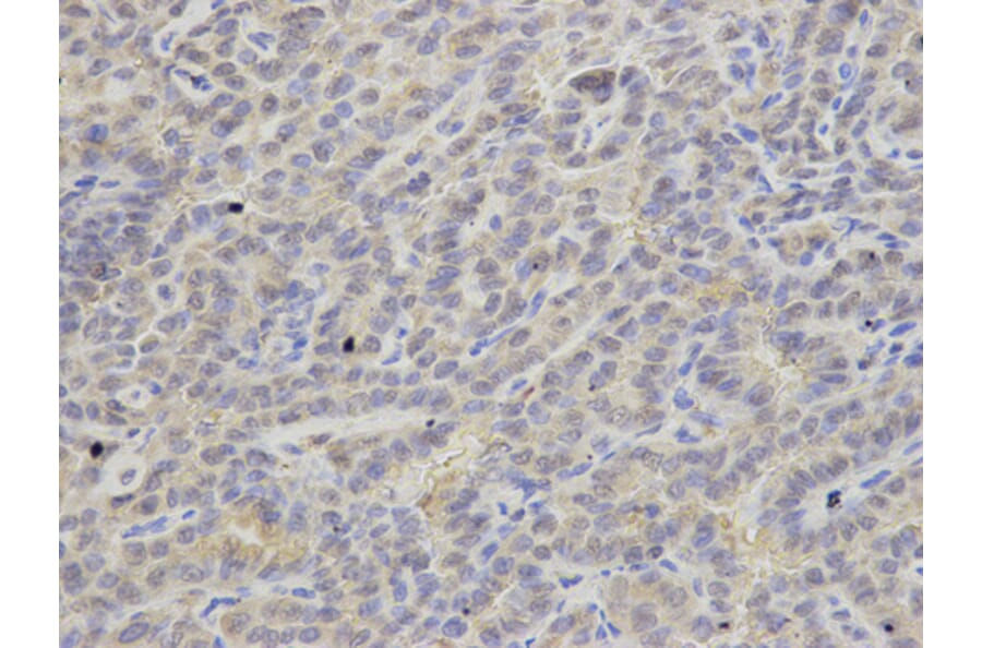 Anti-APRT Antibody from Bioworld Technology (BS7588) - Antibodies.com