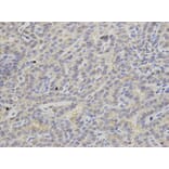 Anti-APRT Antibody from Bioworld Technology (BS7588) - Antibodies.com