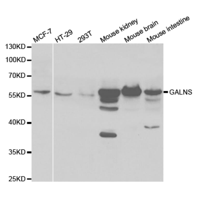Anti-GALNS Antibody from Bioworld Technology (BS7589) - Antibodies.com