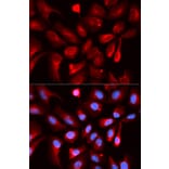 Anti-HIF1AN Antibody from Bioworld Technology (BS7590) - Antibodies.com