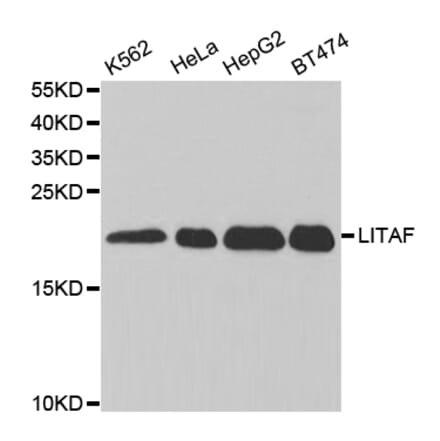 Anti-LITAF Antibody from Bioworld Technology (BS7592) - Antibodies.com