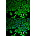 Anti-LITAF Antibody from Bioworld Technology (BS7592) - Antibodies.com