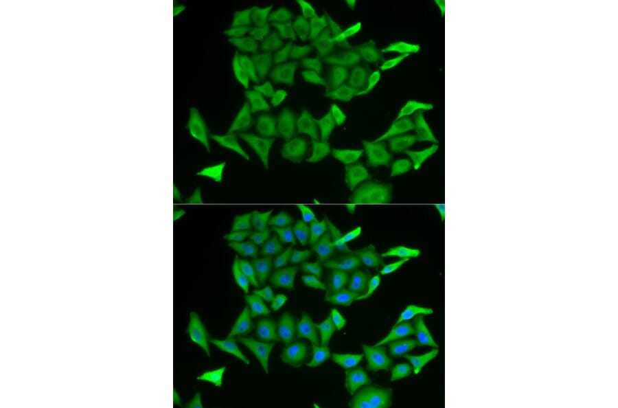 Anti-MB Antibody from Bioworld Technology (BS7593) - Antibodies.com