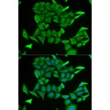 Anti-MB Antibody from Bioworld Technology (BS7593) - Antibodies.com