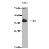 Anti-OTX2 Antibody from Bioworld Technology (BS7595) - Antibodies.com
